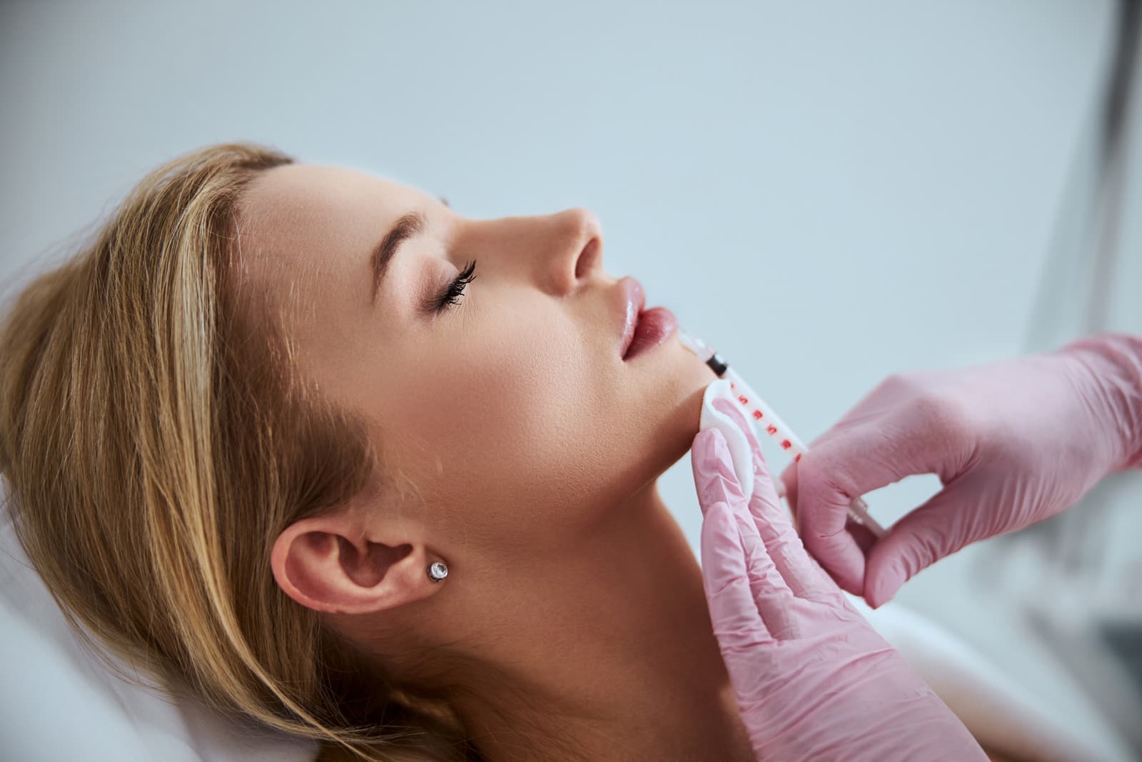 Hyaluronic Acid (Dermal filler)