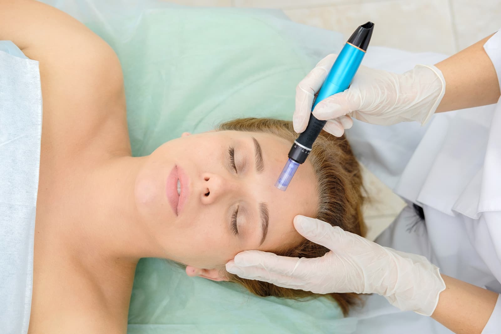 Mesotherapy/microneedling face and body